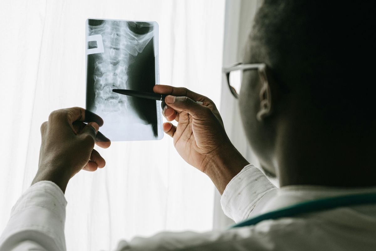 Assessing nervous system health